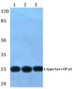 CACNG1 Polyclonal Antibody