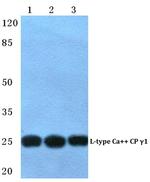 CACNG1 Antibody in Western Blot (WB)