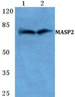 MASP2 Polyclonal Antibody