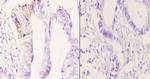 MAST4 Polyclonal Antibody