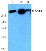 MAST4 Antibody in Western Blot (WB)