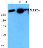 MAST4 Antibody in Western Blot (WB)