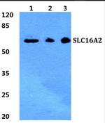 SLC16A2 Polyclonal Antibody