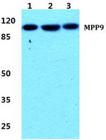 MPP9 Antibody in Western Blot (WB)
