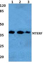 MTERF Polyclonal Antibody