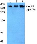 SCN4A Polyclonal Antibody