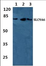 SLC9A6 Polyclonal Antibody