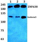ZNF638 Polyclonal Antibody