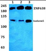 ZNF638 Antibody in Western Blot (WB)