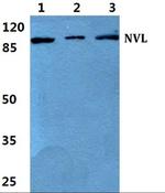 NVL Polyclonal Antibody