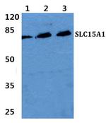 SLC15A1 Polyclonal Antibody