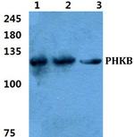 PHKB Polyclonal Antibody