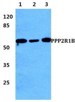 PPP2R1B Antibody in Western Blot (WB)