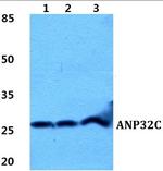 ANP32C Polyclonal Antibody