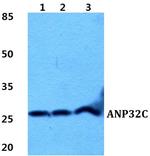 ANP32C Antibody in Western Blot (WB)