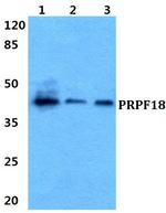 PRPF18 Polyclonal Antibody