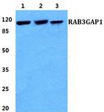 RAB3GAP1 Polyclonal Antibody