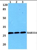 RAB33A Polyclonal Antibody