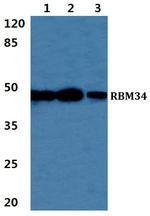 RBM34 Polyclonal Antibody