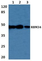 RBM34 Antibody in Western Blot (WB)