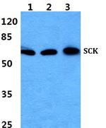 SCK Antibody in Western Blot (WB)