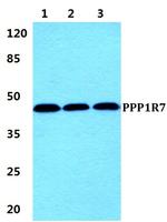 PPP1R7 Polyclonal Antibody