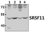 SRSF11 Polyclonal Antibody