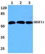 SRSF11 Antibody in Western Blot (WB)