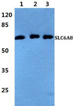 SLC6A8 Polyclonal Antibody