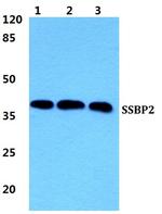 SSBP2 Antibody in Western Blot (WB)