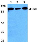 SFRS8 Polyclonal Antibody