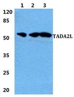 TADA2L Polyclonal Antibody