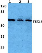 TBX18 Polyclonal Antibody