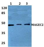 MAGEC2 Polyclonal Antibody