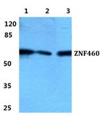 ZNF460 Antibody in Western Blot (WB)