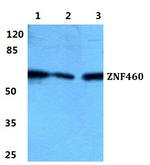 ZNF460 Antibody in Western Blot (WB)