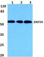 ZNF50 Antibody in Western Blot (WB)