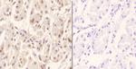ZNF50 Polyclonal Antibody