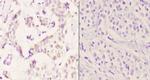 PTGR2 Polyclonal Antibody