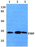 FSBP Polyclonal Antibody