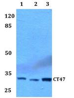 CT47 Antibody in Western Blot (WB)