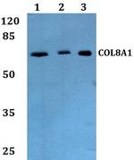 COL8A1 Polyclonal Antibody