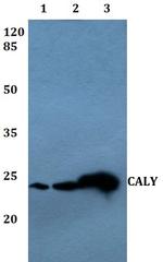 CALY Polyclonal Antibody