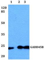 GADD45B Antibody in Western Blot (WB)