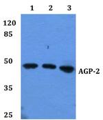 ORM2 Antibody in Western Blot (WB)