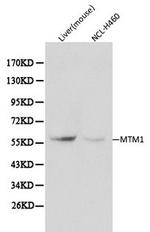 MTM1 Antibody in Western Blot (WB)