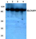 SLC4A9 Polyclonal Antibody