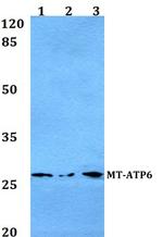 MT-ATP6 Antibody in Western Blot (WB)