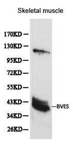 BVES Polyclonal Antibody