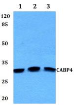 CABP4 Polyclonal Antibody